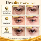 80PCS 24K Gold Collagen Under Eye & Smile Line Patches